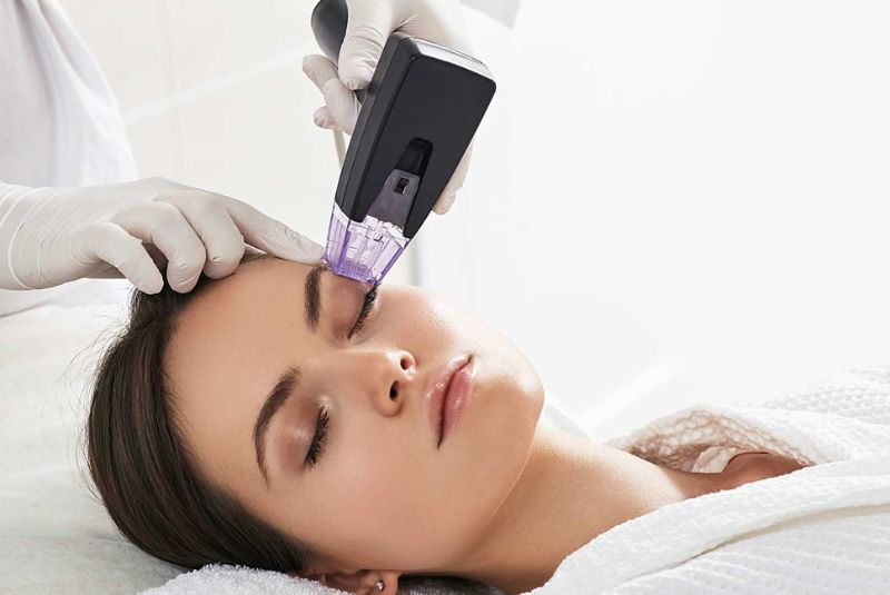 Morpheus8 vs HIFU: ¿cuál es mejor para el rejuvenecimiento facial en Ibiza?
